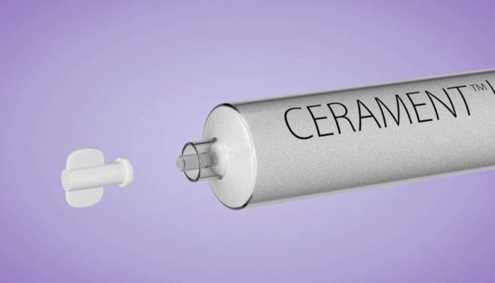 Pre-clinical results from Bonesupport